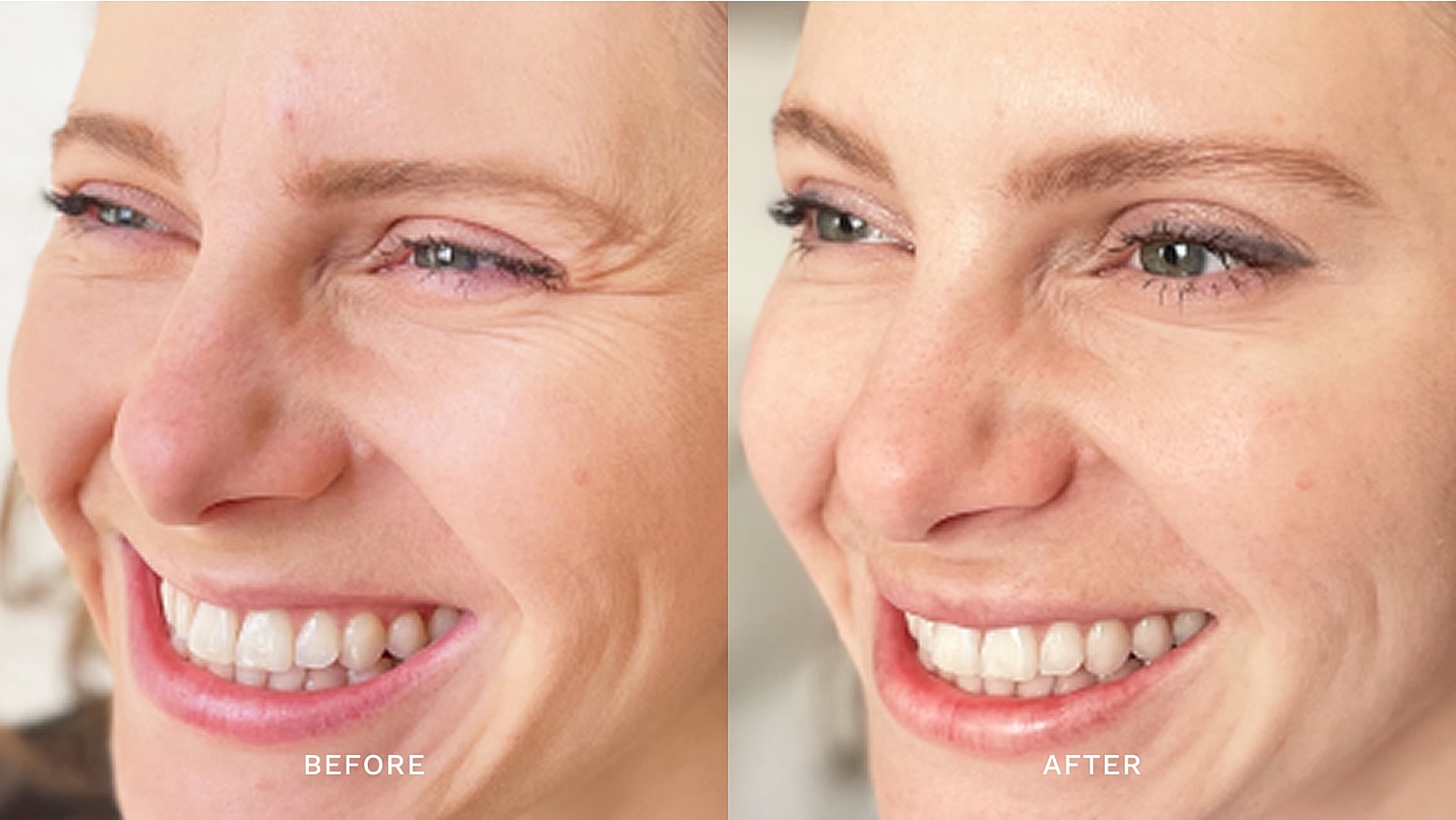 Comparison of skincare results, before and after.