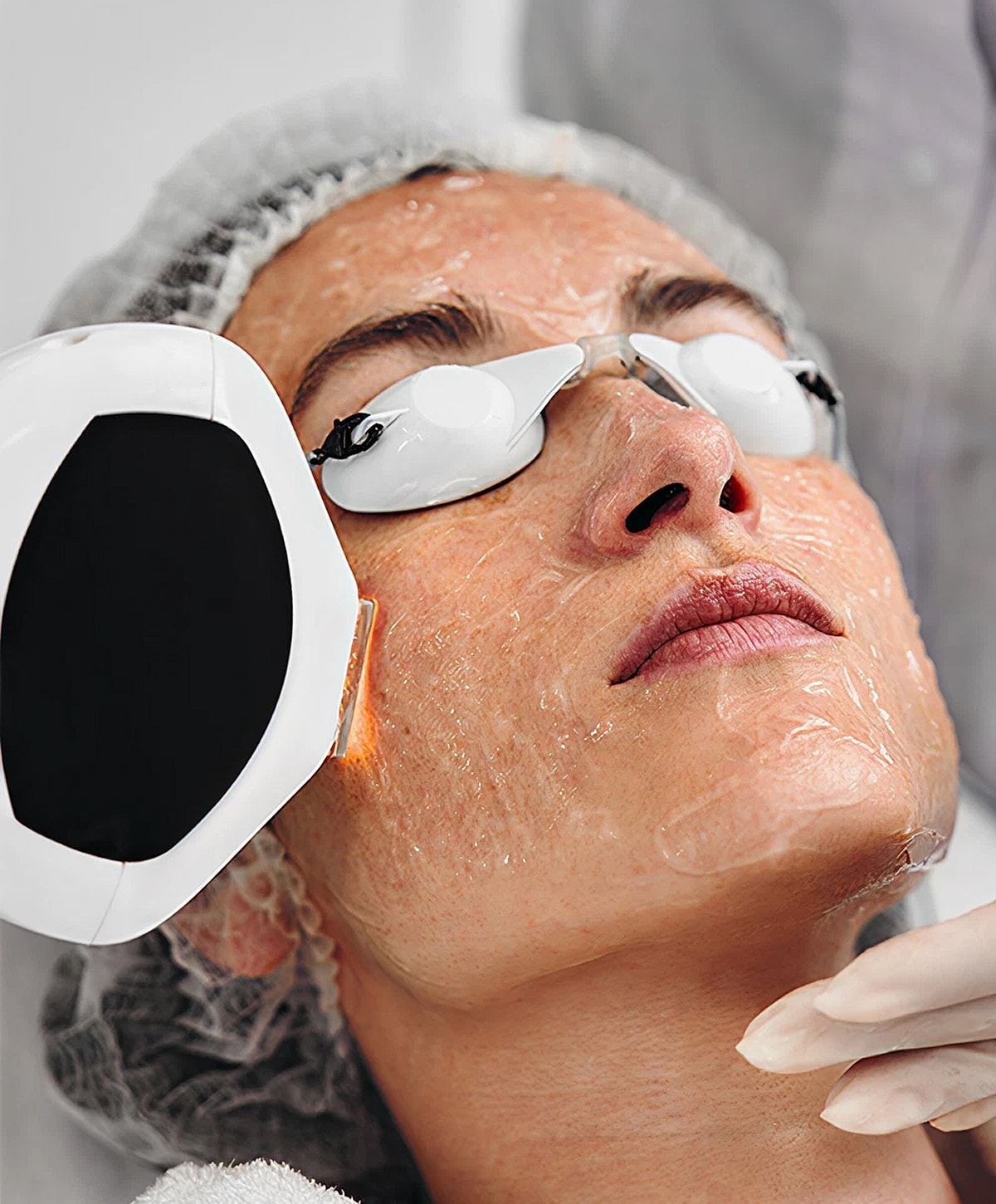 Injecting lip filler in a cosmetic procedure.